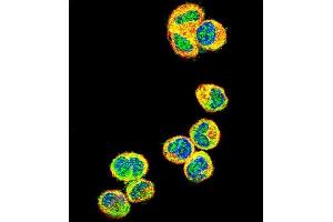 Confocal immunofluorescent analysis of AKT1 Antibody (N-term) (ABIN391212 and ABIN2841290) with MDA-M cell followed by Alexa Fluor 488-conjugated goat anti-rabbit lgG (green). (AKT1 Antikörper  (N-Term))