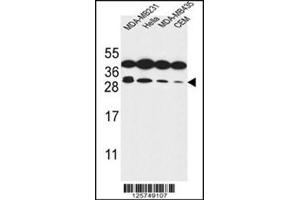 Western blot analysis of Syntaxin 10 / STX10 Antibody (N-term) in MDA-MB231, Hela, MDA-MB435, CEM cell line lysates (35ug/lane). (Syntaxin 10 Antikörper  (N-Term))