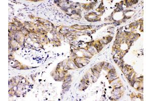 Immunohistochemistry (IHC) image for anti-NDRG Family Member 3 (NDRG3) (AA 181-239) antibody (ABIN5518857)