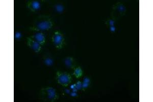 Anti-AK3 mouse monoclonal antibody (ABIN2452718) immunofluorescent staining of COS7 cells transiently transfected by pCMV6-ENTRY AK3 (RC204408).