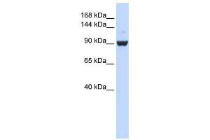 DHX34 antibody used at 1 ug/ml to detect target protein. (DHX34 Antikörper)