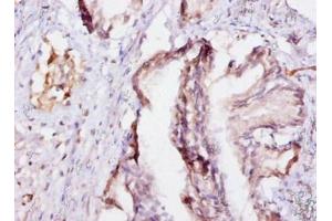 Immunohistochemistry of paraffin-embedded human prostate tissue using ABIN7152198 at dilution of 1:10 (eIF4EBP2 Antikörper  (AA 1-120))