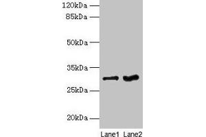 Western blot All lanes: FGFR1OP2 antibody at 6 μg/mL Lane 1: Mouse gonadal tissue Lane 2: Human placenta tissue Secondary Goat polyclonal to rabbit IgG at 1/10000 dilution Predicted band size: 30, 25, 21 kDa Observed band size: 30 kDa (FGFR1OP2 Antikörper  (AA 1-172))