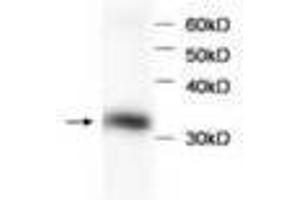 Image no. 1 for anti-Hemoglobin beta (HBB) antibody (ABIN791524) (Hemoglobin Subunit beta Antikörper)