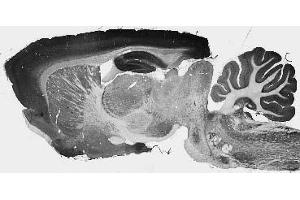 Adult rat whole brain immunohistochemistry. (KCNT2 Antikörper  (AA 564-624))