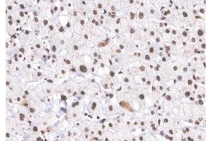 ABIN6266524 at 1/200 staining human Liver tissue sections by IHC-P. (Cyclin E1 Antikörper  (C-Term))