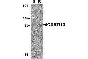 Western blot analysis of CARD10 expression in EL4 cell lysate with AP30183PU-N CARD10 antibody at (A) 5 and (B) 10 μg /ml.