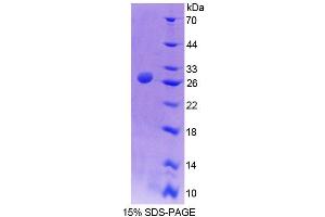 SDS-PAGE analysis of Mouse AGXT Protein. (AGXT Protein)