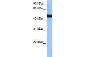 WB Suggested Anti-PIGK Antibody Titration:  0.