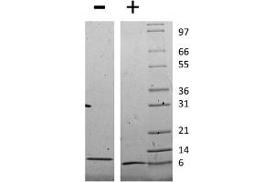 SDS-PAGE of Mouse Monocyte Chemotactic Protein-2 (CCL8) Recombinant Protein SDS-PAGE of Mouse Monocyte Chemotactic Protein-2 (CCL8) Recombinant Protein. (CCL8 Protein)