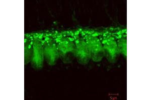 Immunostaining of cochlear inner hair cells from 3 weeks old rats.