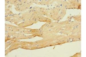 Immunohistochemistry of paraffin-embedded human heart tissue using ABIN7175582 at dilution of 1:100 (CACNA2D4 Antikörper  (AA 934-1115))