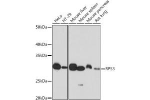 Western blot analysis of extracts of various cell lines, using RPS3 Rabbit mAb (ABIN7270025) at 1:1000 dilution. (RPS3 Antikörper)