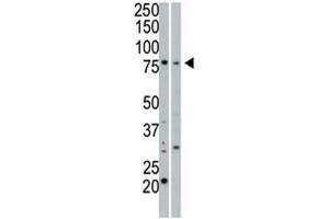Western Blotting (WB) image for anti-Protein Kinase, CGMP-Dependent, Type I (PRKG1) (AA 629-660) antibody (ABIN3029798)