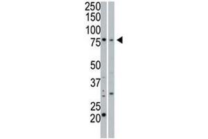 cGKI beta antibody used in western blot to detect cGKIbeta in 293 cell lysate (Lane 1) and mouse small intestine tissue lysate (2). (PRKG1 Antikörper  (AA 629-660))