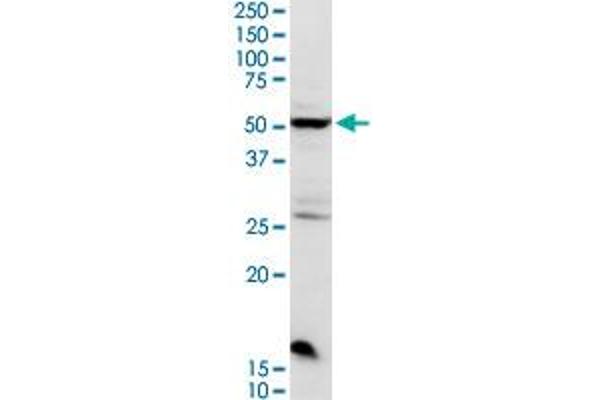 CHRDL2 anticorps  (AA 1-451)