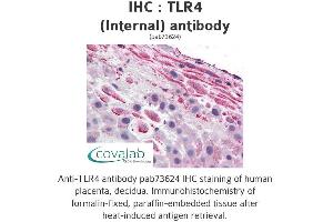 Image no. 1 for anti-Toll-Like Receptor 4 (TLR4) (Internal Region) antibody (ABIN1740115) (TLR4 Antikörper  (Internal Region))