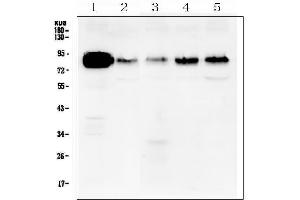 Western blot analysis of cortactin using anti-cortactin antibody (ABIN6719306).