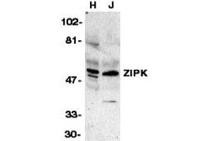 Western Blotting (WB) image for anti-Death-Associated Protein Kinase 3 (DAPK3) (Middle Region) antibody (ABIN1031183) (DAPK3 Antikörper  (Middle Region))