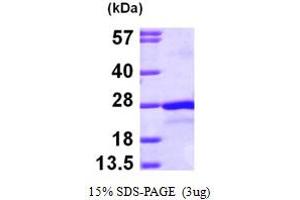 SDS-PAGE (SDS) image for Protein tyrosine Phosphatase Type IVA, Member 2 (PTP4A2) (AA 1-167) protein (His tag) (ABIN667818)