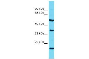 Host: Rabbit  Target Name: l7Rn6  Sample Tissue: Rat Spleen lysates  Antibody Dilution: 1.