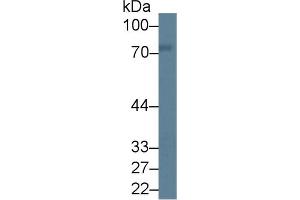 Western Blot; Sample: Rat Cerebrum lysate; Primary Ab: 1µg/ml Rabbit Anti-Rat PKCd Antibody Second Ab: 0. (PKC delta Antikörper  (AA 347-601))