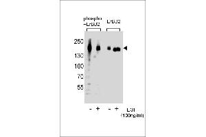 Western blot analysis of extracts from A431 cells, untreated or treated with EGF, 100 ng/mL, using Phospho-ERBB2- or ERBB2 Antibody (right). (ErbB2/Her2 Antikörper  (pTyr1127))