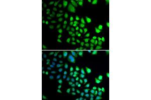 Immunofluorescence analysis of U2OS cells using RBBP5 antibody (ABIN5974189). (RBBP5 Antikörper)