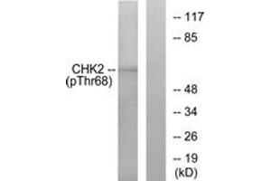 Western blot analysis of extracts from Jurkat cells treated with UV, using Chk2 (Phospho-Thr68) Antibody. (CHEK2 Antikörper  (pThr68))