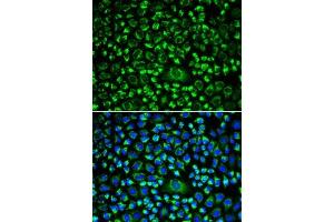 Immunofluorescence analysis of HeLa cells using TAPBP antibody (ABIN6132744, ABIN6148847, ABIN6148849 and ABIN6217320). (TAPBP Antikörper  (AA 30-260))