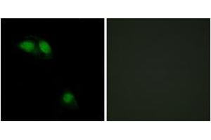 Immunofluorescence analysis of HeLa cells, using IRS-1 (Phospho-Ser312) Antibody. (IRS1 Antikörper  (pSer312))