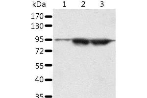 Western Blot analysis of A549 and lncap cell, Human seminoma tissue using SPATA20 Polyclonal Antibody at dilution of 1:1000 (SPATA20 Antikörper)