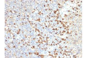 Formalin-fixed, paraffin-embedded human Tonsil stained with TIM3 Mouse Monoclonal Antibody (TIM3/2399). (TIM3 Antikörper  (AA 22-202))