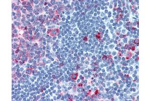 Anti-CELSR1 antibody IHC of human tonsil.