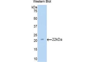 Western blot analysis of the recombinant protein. (LAMC3 Antikörper  (AA 1250-1418))