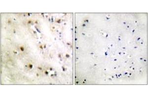 Immunohistochemistry analysis of paraffin-embedded human brain tissue, using TISB (Ab-92) Antibody. (ZFP36L1 Antikörper  (AA 58-107))