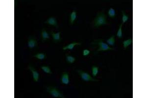 Image no. 1 for anti-Cancer/testis Antigen 1B (CTAG1B) antibody (ABIN1499895) (CTAG1B Antikörper)