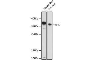 Western blot analysis of extracts of various cell lines using RHD Polyclonal Antibody at dilution of 1:1000. (RHD Antikörper)