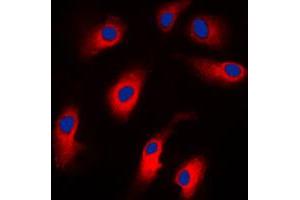 Immunofluorescent analysis of Caspase 7 staining in Jurkat cells. (Caspase 7 Antikörper  (N-Term))