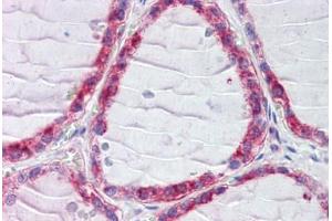 Human Thyroid (formalin-fixed, paraffin-embedded) stained with CLIP1 antibody ABIN462301 followed by biotinylated secondary antibody, alkaline phosphatase-streptavidin and chromogen. (CLIP1 Antikörper  (AA 1404-1417))