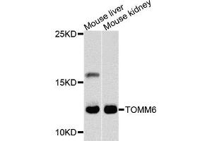 Western blot analysis of extracts of mouse liver and mouse kidney cells, using TOMM6 antibody. (TOMM6 Antikörper)