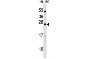 C18orf26 Antibody (N-term) western blot analysis in HL-60 cell line lysates (35µg/lane). (DYNAP Antikörper  (N-Term))