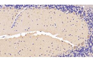 Immunohistochemistry (IHC) image for anti-Brain-Derived Neurotrophic Factor (BDNF) (AA 20-252) antibody (ABIN7430375)