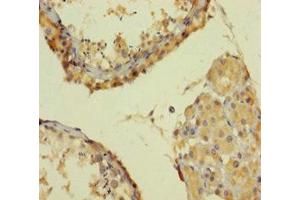 Immunohistochemistry of paraffin-embedded human testis tissue using ABIN7164521 at dilution of 1:100 (SMARCA2 Antikörper  (AA 700-1216))