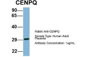 Western Blotting (WB) image for anti-Centromere Protein Q (CENPQ) (N-Term) antibody (ABIN2787070)