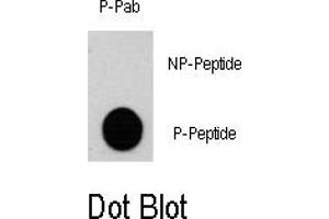 Image no. 1 for anti-Ribosomal Protein S6 Kinase, 90kDa, Polypeptide 3 (RPS6KA3) (pSer369) antibody (ABIN358394) (RPS6KA3 Antikörper  (pSer369))