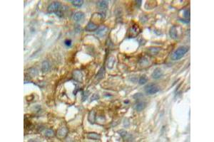 Used in DAB staining on fromalin fixed paraffin-embedded lung tissue (CD93 Antikörper  (AA 82-369))