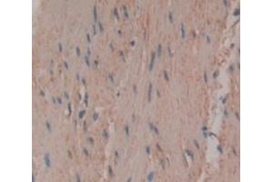 IHC-P analysis of Human Tissue, with DAB staining. (TNNT3 Antikörper  (AA 147-269))