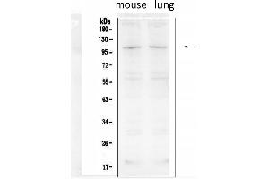 Western blot analysis of TRPC6 using anti- TRPC6 antibody .