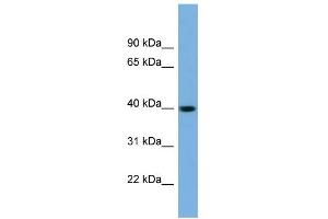 WB Suggested Anti-SAE1 Antibody Titration: 0.